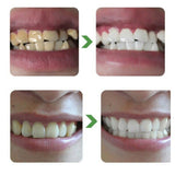 Foam Toothpaste Tooth Stains Remove-Plaque Teeth Whitening Hygiene Oral Cleaning